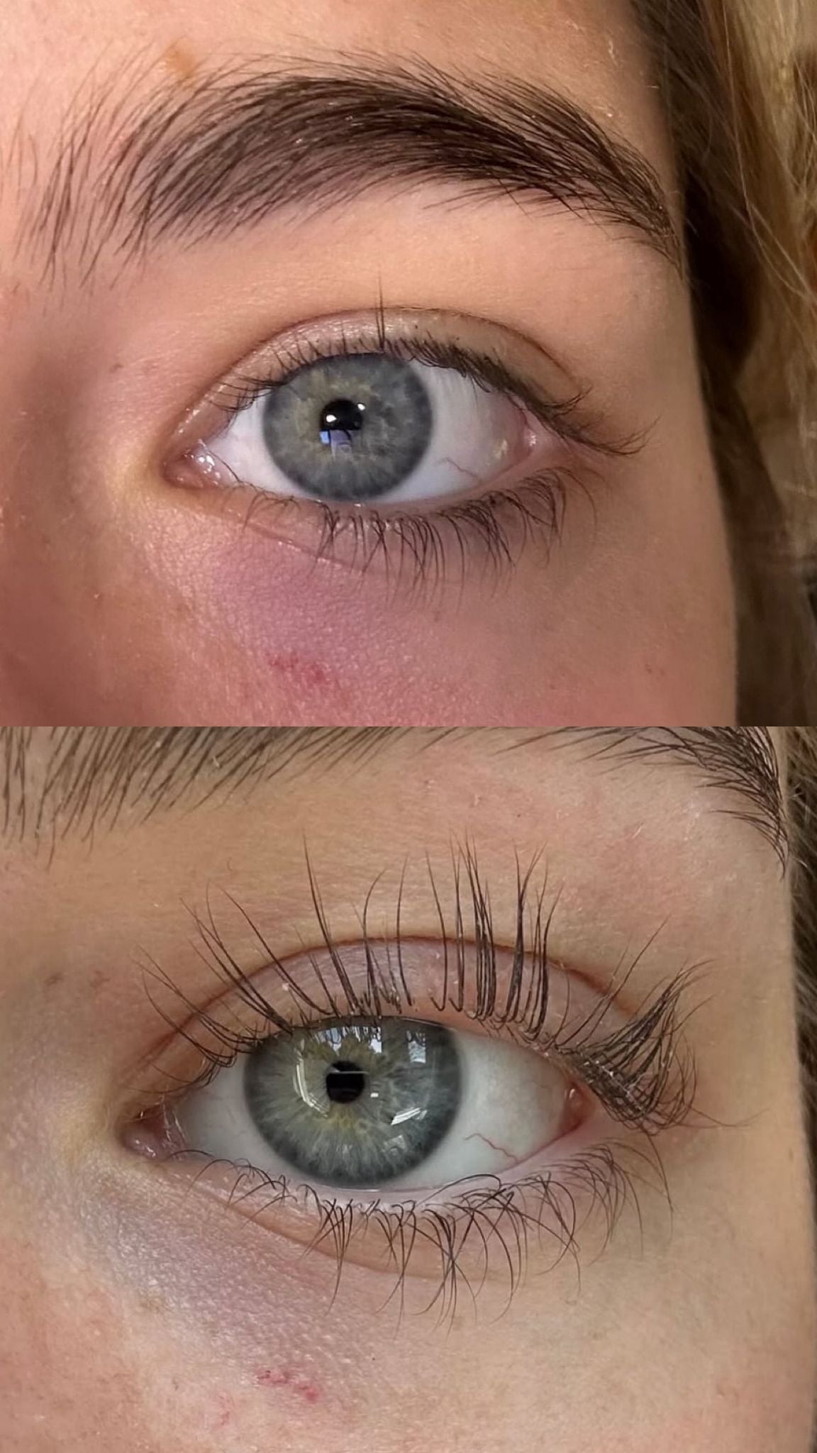 Before & After
