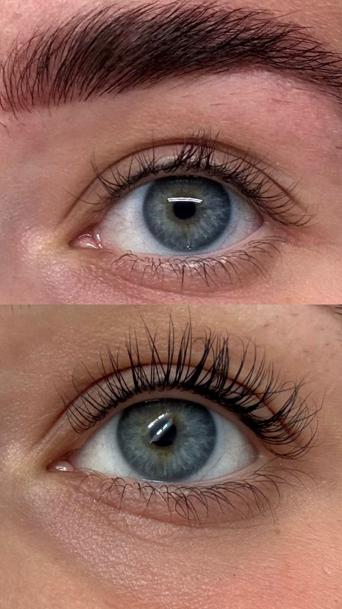 Before & After