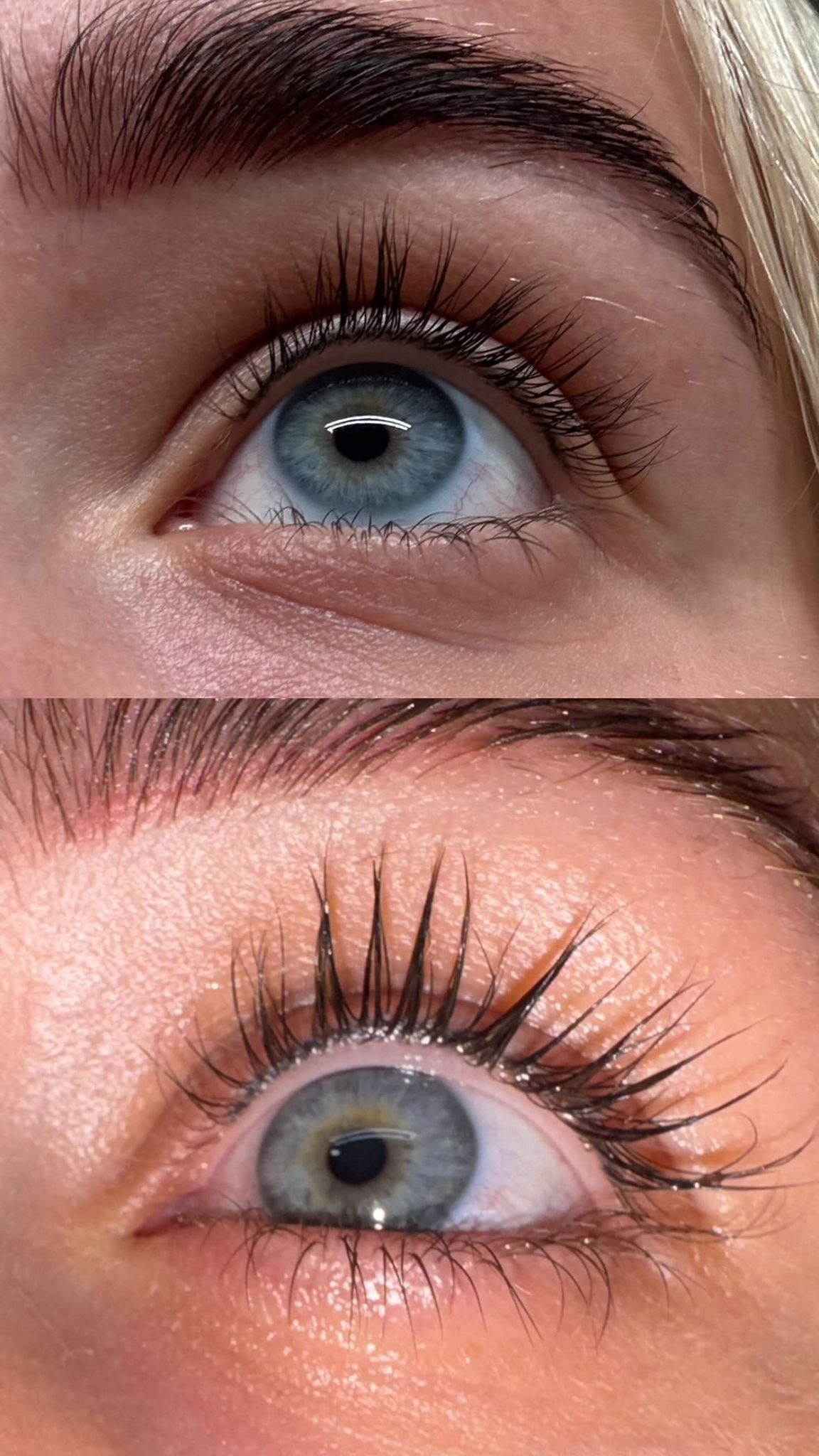 Before & After